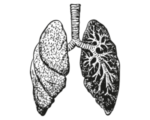 cancer mesothelioma