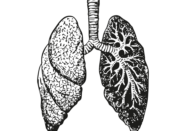 cancer mesothelioma