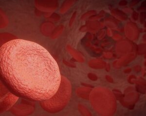 leucemia crónica mieloide