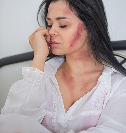 síntomas de la leucemia