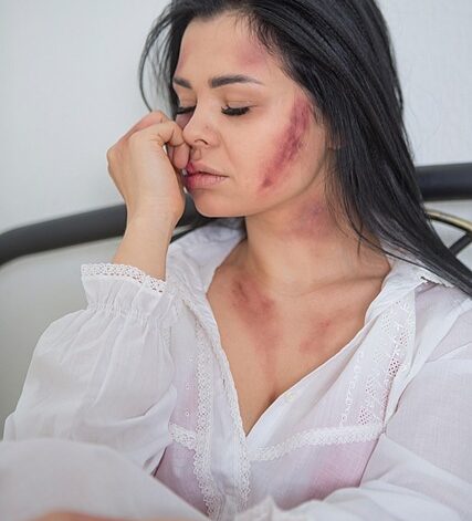 síntomas de la leucemia