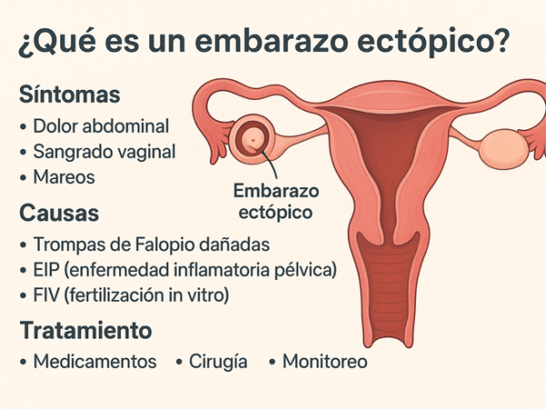 que es un embarazo ectópico