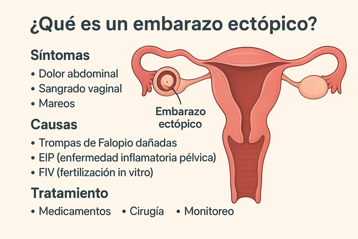 que es un embarazo ectópico