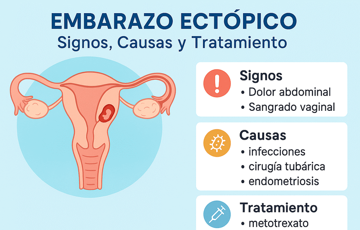 embarazo ectópico