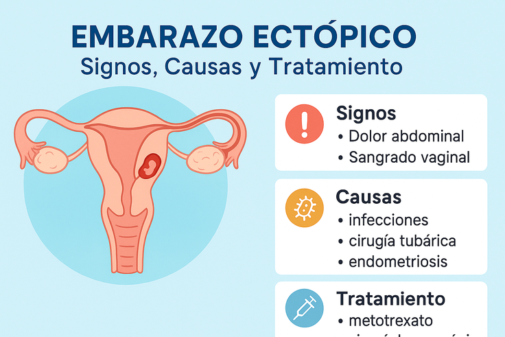 embarazo ectópico
