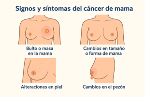 Signos y síntomas del cáncer de mama