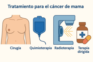Tratamientos para el cáncer de mama