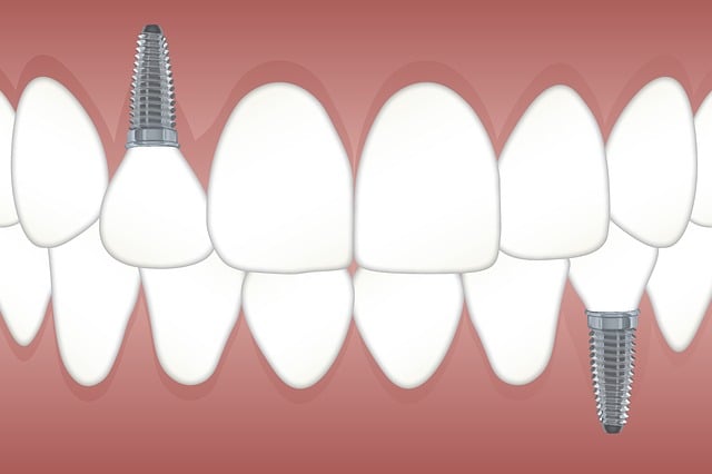 implante dental