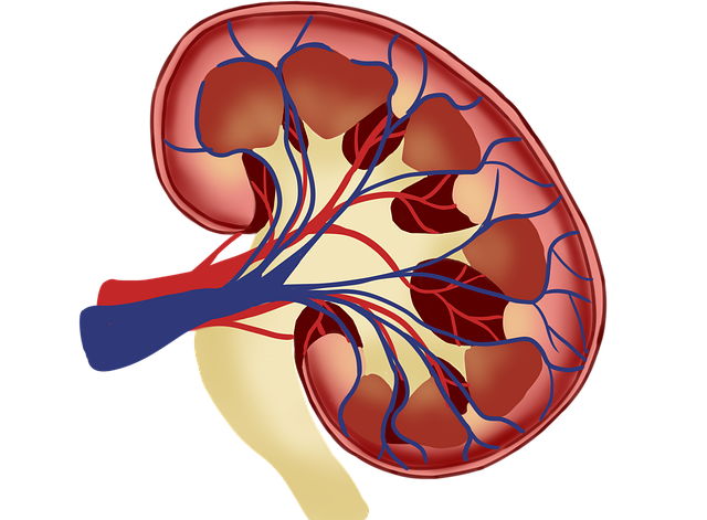 síntomas de piedras en los riñones