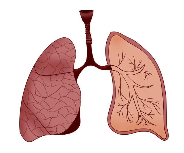 mesotelioma maligno