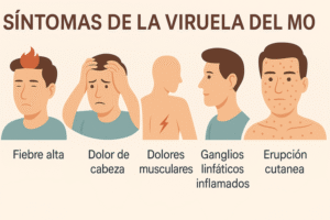 viruela del mono